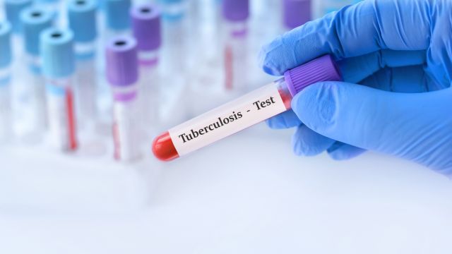 Запустил неделю для бесплатных видов туберкулеза
