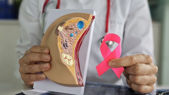 Новый подход в лечении агрессивных форм рака молочной железы показывает 100% выживаемость
