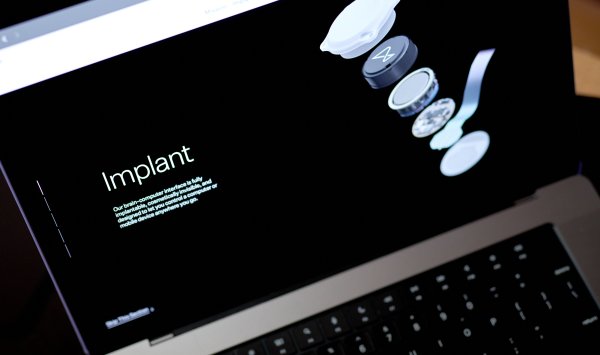 Нейронное устройство Neuralink заставило обезьяну увидеть то, чего не существует