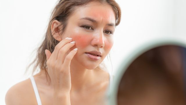 Лучшие активные ингредиенты для чувствительной кожи