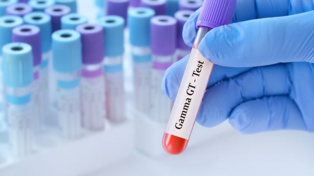 Лабораторные маркеры для печеночных нарушений — когда они тревожат?