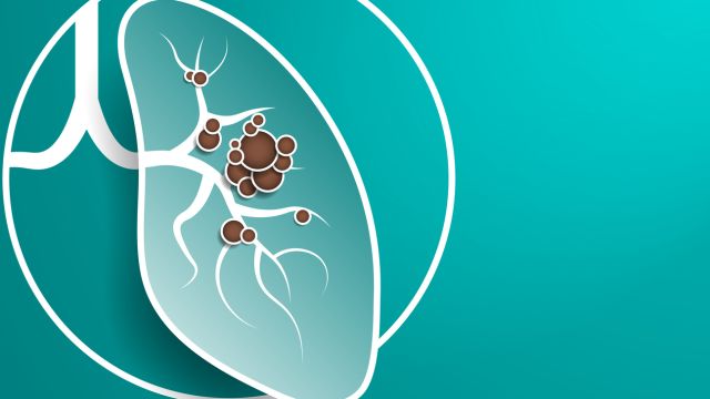 Pleuropulmornary Blastom — редкое злокачественное образование в детстве