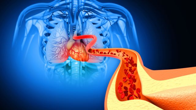 Бактерии во рту могут вызвать сердечный приступ