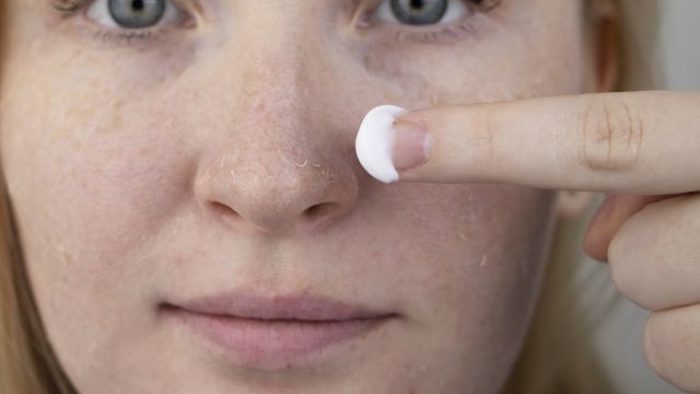 Как справиться с сухой кожей?