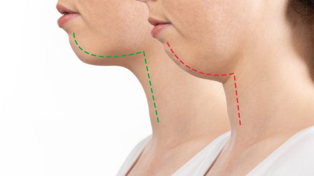 Последствия глубокого укуса