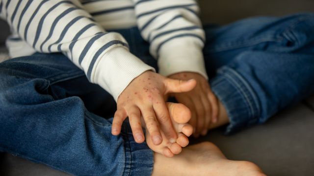 Как распознать шестую закономерность в сезоне острых вирусных инфекций?