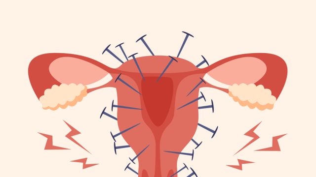 Боль во время секса - какова роль вагинизма?