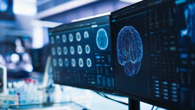 II обнаруживает скрытые поражения мозга у детей с эпилепсией