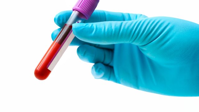 MCV и MCHC – о чем говорят показатели эритроцитов?