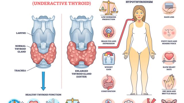Как щитовидная железа влияет на вес и настроение?