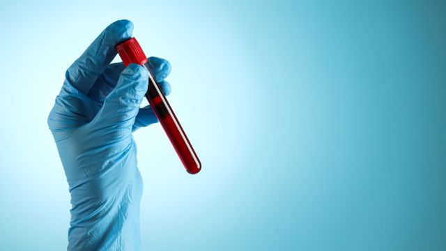 Базофилы и эозинофилы – о чем говорит их аномальный уровень?