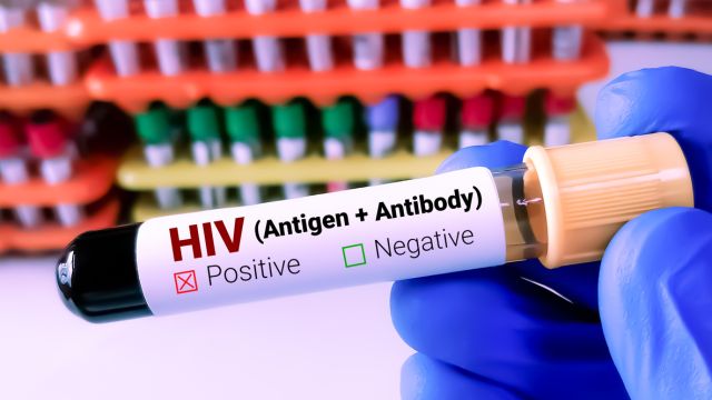 Вирусная нагрузка – важнейший лабораторный показатель мониторинга ВИЧ-инфекции