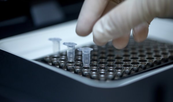 Цифровизация лабораторий открывает путь к персонализированной медицине