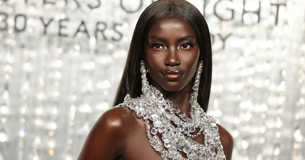 У 28-летней модели Анок Яй диагностирован врожденный дефект, из-за которого она не может дышать.