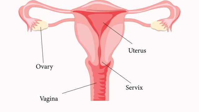 Язва шейки матки – что это на самом деле?