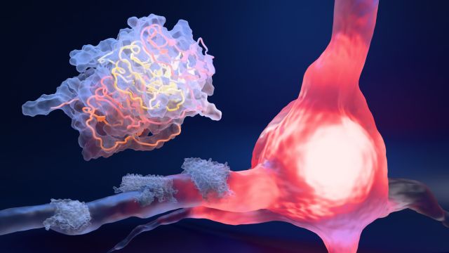 Светотерапия архаэродпсином-3 – новый прорыв в разрушении опухолевых клеток