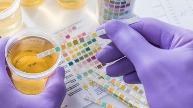 Как связаны дальтонизм и рак мочевого пузыря?