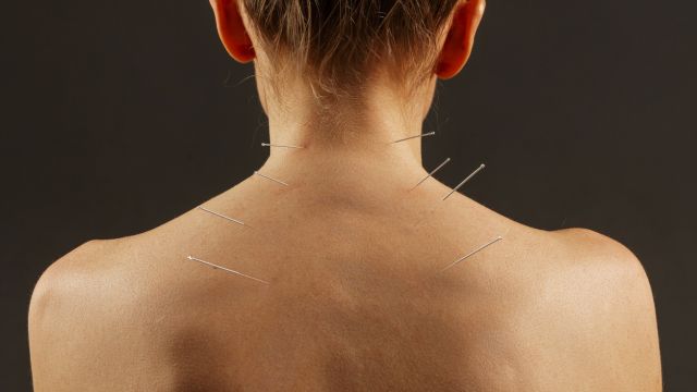 Иглоукалывание при хронической боли