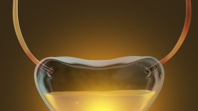 Что вызывает образование полипов мочевого пузыря?