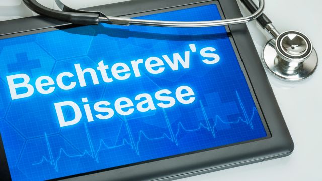 Кардиологические проявления при болезни Бехтерева