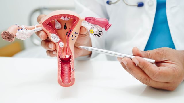 Вместо мазка из Папаниколау они могут проверить менструальную кровь на ВПЧ.