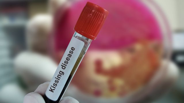 Исследование дает надежду на борьбу с вирусом Эпштейна-Барра