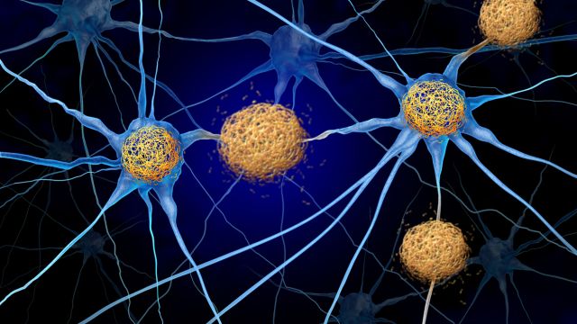 Как некоторым клеткам мозга удается защитить себя от болезни Альцгеймера?