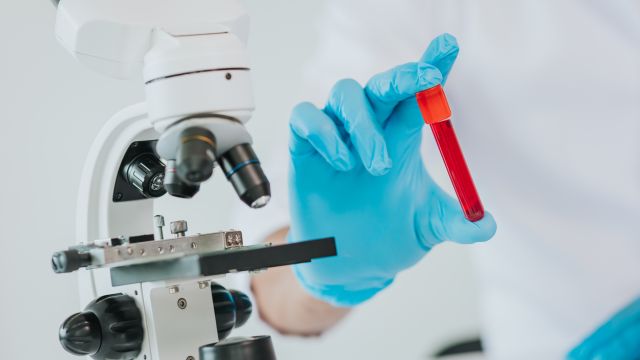 Галектин-3 – биомаркер фиброза, имеющий применение в кардиологии, нефрологии и онкологии.