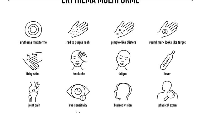 Мультиформная эритема – многогранная сыпь.