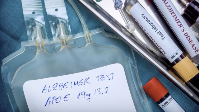 Маркер крови для болезни Альцгеймера также был обнаружен и при других заболеваниях.