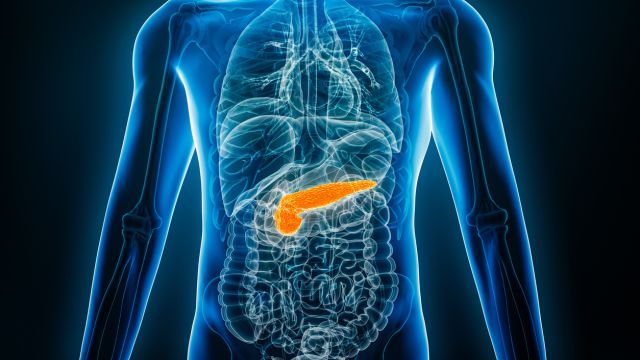 Рак поджелудочной железы с самого начала подавляет иммунитет