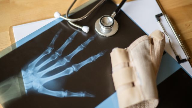 Какие несчастные случаи на производстве чаще всего происходят на производстве?