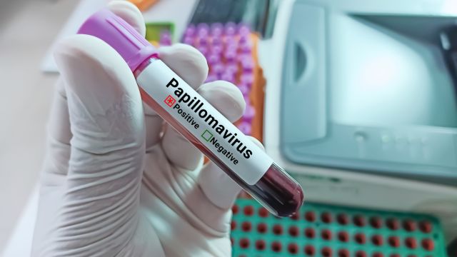 Вирус папилломы человека – как можно заразиться?