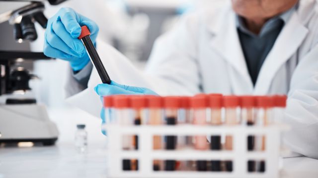 Анализ крови выявляет различные виды рака на ранней стадии.